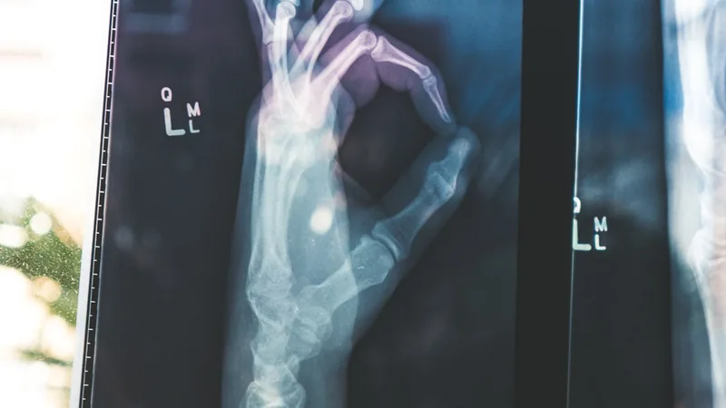 Imaging diagnostico biomedico ad alta risoluzione con reticolo analitico, rappresentazione dell'intelligenza artificiale applicata all'analisi delle cartelle cliniche elettroniche